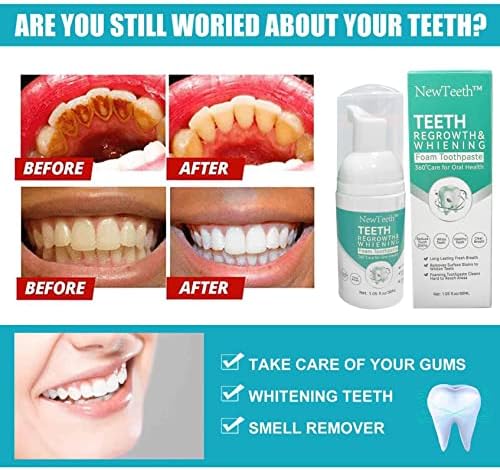 Течност за Изплакване на Устата NewTeeth За Избелване на Зъби, Пяна За Избелване на Зъби, Пяна за Избелване